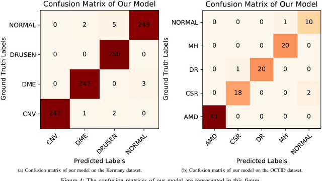 Figure 4 for ROCT-Net: A new ensemble deep convolutional model with improved spatial resolution learning for detecting common diseases from retinal OCT images