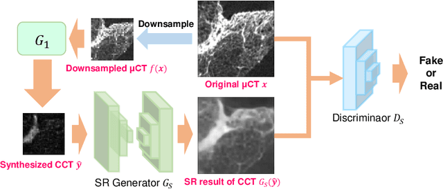 Figure 3 for Micro CT Image-Assisted Cross Modality Super-Resolution of Clinical CT Images Utilizing Synthesized Training Dataset