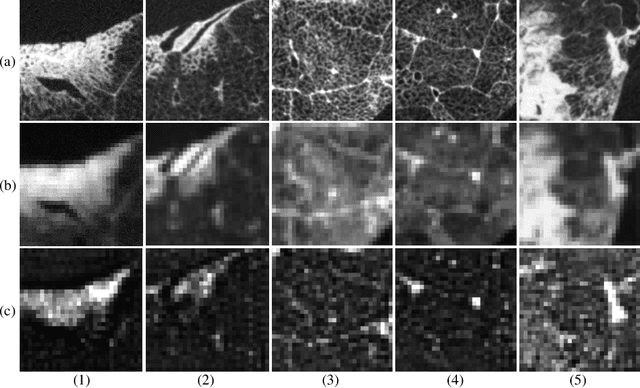 Figure 4 for Micro CT Image-Assisted Cross Modality Super-Resolution of Clinical CT Images Utilizing Synthesized Training Dataset