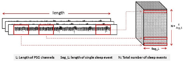 Figure 2 for Automate Obstructive Sleep Apnea Diagnosis Using Convolutional Neural Networks