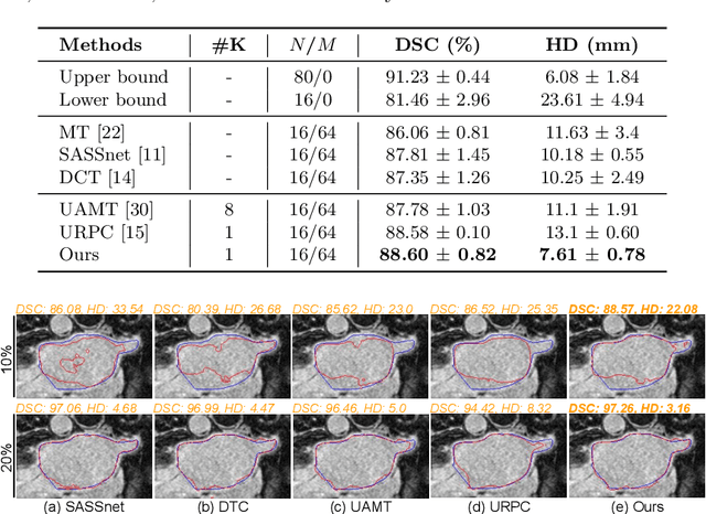 Figure 3 for Leveraging Labeling Representations in Uncertainty-based Semi-supervised Segmentation