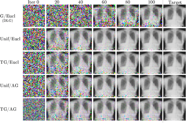 Figure 1 for Analysing the Influence of Attack Configurations on the Reconstruction of Medical Images in Federated Learning