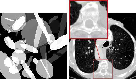 Figure 2 for Unsupervised Knowledge-Transfer for Learned Image Reconstruction