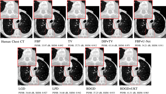 Figure 3 for Unsupervised Knowledge-Transfer for Learned Image Reconstruction