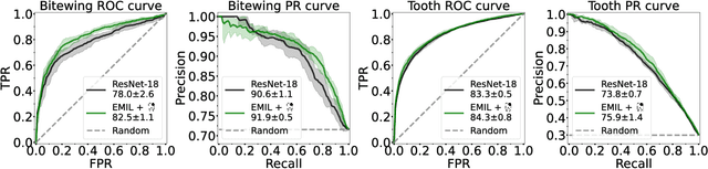 Figure 3 for Interpretable and Interactive Deep Multiple Instance Learning for Dental Caries Classification in Bitewing X-rays