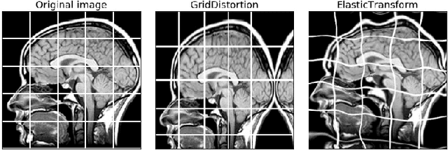 Figure 4 for Albumentations: fast and flexible image augmentations