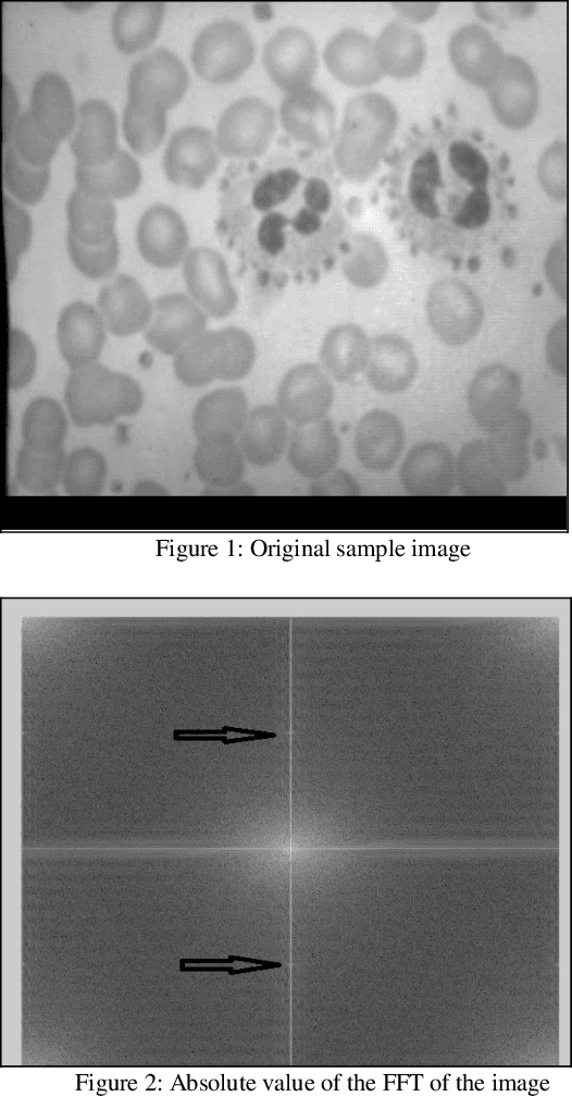 Figure 1 for A fast semi-automatic method for classification and counting the number and types of blood cells in an image