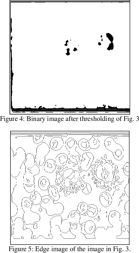 Figure 3 for A fast semi-automatic method for classification and counting the number and types of blood cells in an image