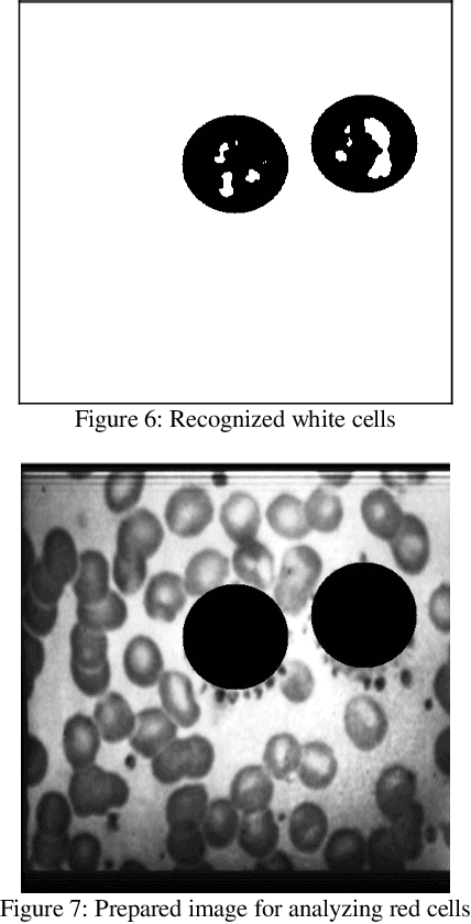 Figure 4 for A fast semi-automatic method for classification and counting the number and types of blood cells in an image