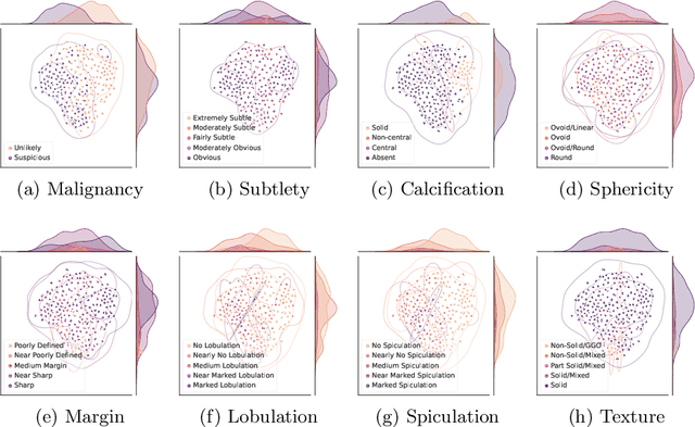 Figure 4 for Reducing Annotation Need in Self-Explanatory Models for Lung Nodule Diagnosis