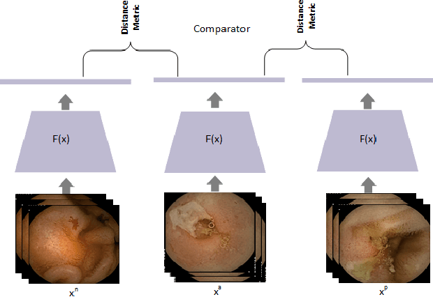 Figure 1 for Lesion2Vec: Deep Metric Learning for Few-Shot Multiple Lesions Recognition in Wireless Capsule Endoscopy Video