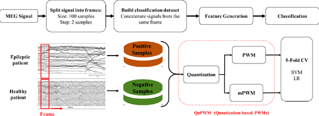 Figure 1 for QuPWM: Feature Extraction Method for MEG Epileptic Spike Detection