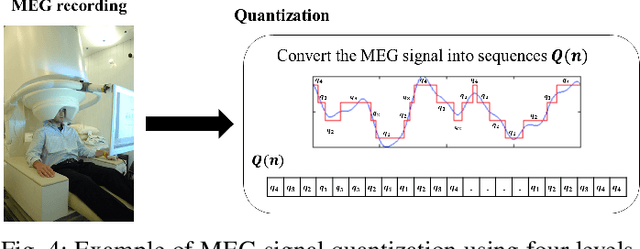 Figure 4 for QuPWM: Feature Extraction Method for MEG Epileptic Spike Detection