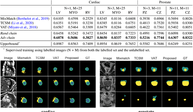 Figure 4 for Enhancing MR Image Segmentation with Realistic Adversarial Data Augmentation