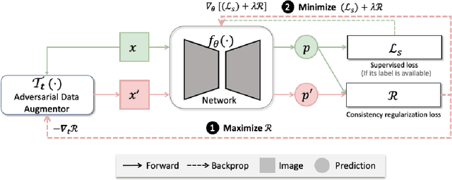 Figure 1 for Enhancing MR Image Segmentation with Realistic Adversarial Data Augmentation
