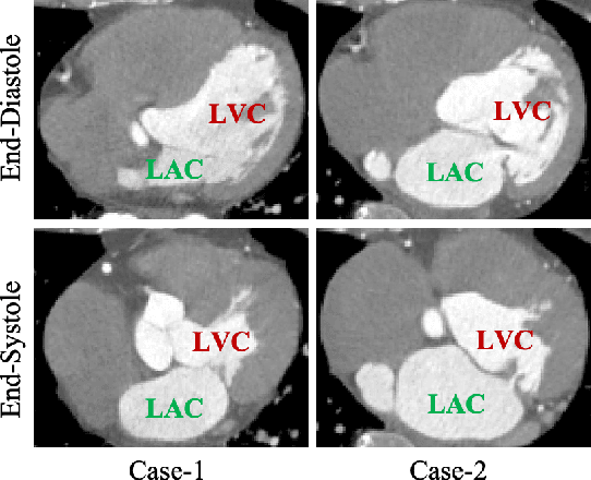 Figure 1 for Unsupervised Landmark Detection Based Spatiotemporal Motion Estimation for 4D Dynamic Medical Images