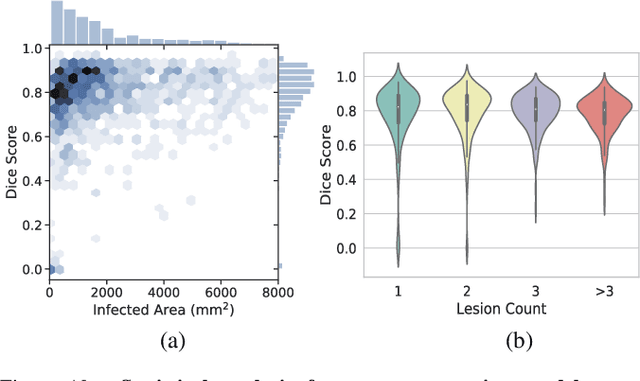 Figure 2 for JCS: An Explainable COVID-19 Diagnosis System by Joint Classification and Segmentation