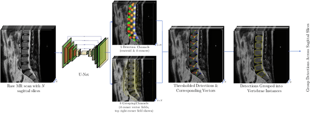 Figure 1 for A Convolutional Approach to Vertebrae Detection and Labelling in Whole Spine MRI