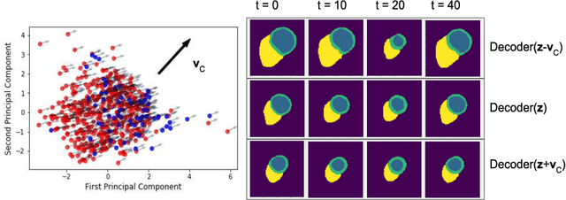 Figure 4 for Global and Local Interpretability for Cardiac MRI Classification