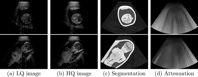 Figure 1 for Deep Image Translation for Enhancing Simulated Ultrasound Images