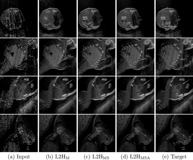Figure 4 for Deep Image Translation for Enhancing Simulated Ultrasound Images