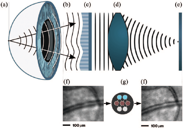 Figure 2 for Embedded deep learning in ophthalmology: Making ophthalmic imaging smarter