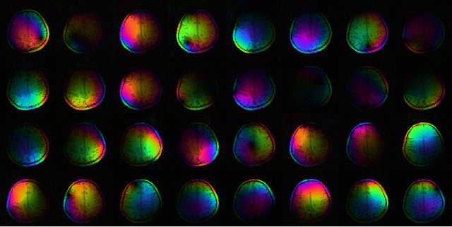 Figure 1 for Parallel Magnetic Resonance Imaging