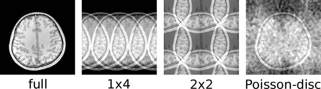 Figure 2 for Parallel Magnetic Resonance Imaging