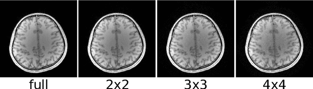 Figure 4 for Parallel Magnetic Resonance Imaging