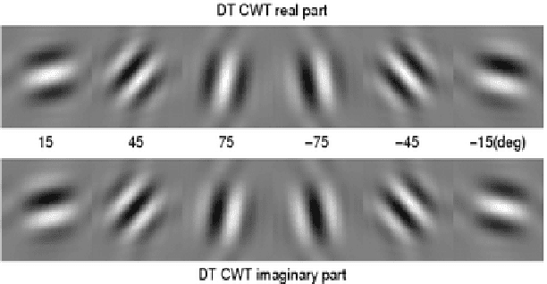 Figure 1 for A Novel adaptive optimization of Dual-Tree Complex Wavelet Transform for Medical Image Fusion