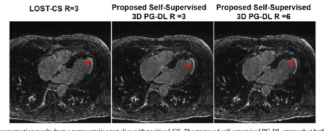 Figure 3 for Self-Supervised Physics-Guided Deep Learning Reconstruction For High-Resolution 3D LGE CMR