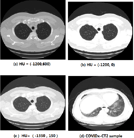 Figure 1 for Data Augmentation and CNN Classification For Automatic COVID-19 Diagnosis From CT-Scan Images On Small Dataset