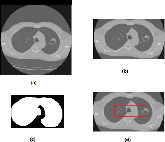 Figure 3 for Data Augmentation and CNN Classification For Automatic COVID-19 Diagnosis From CT-Scan Images On Small Dataset