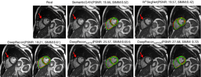 Figure 3 for DeepRecon: Joint 2D Cardiac Segmentation and 3D Volume Reconstruction via A Structure-Specific Generative Method