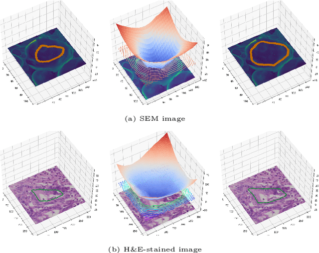 Figure 3 for Multi-task deep learning for image segmentation using recursive approximation tasks