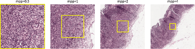 Figure 1 for Multi-Resolution Networks for Semantic Segmentation in Whole Slide Images