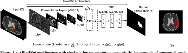 Figure 1 for Class Balanced PixelNet for Neurological Image Segmentation