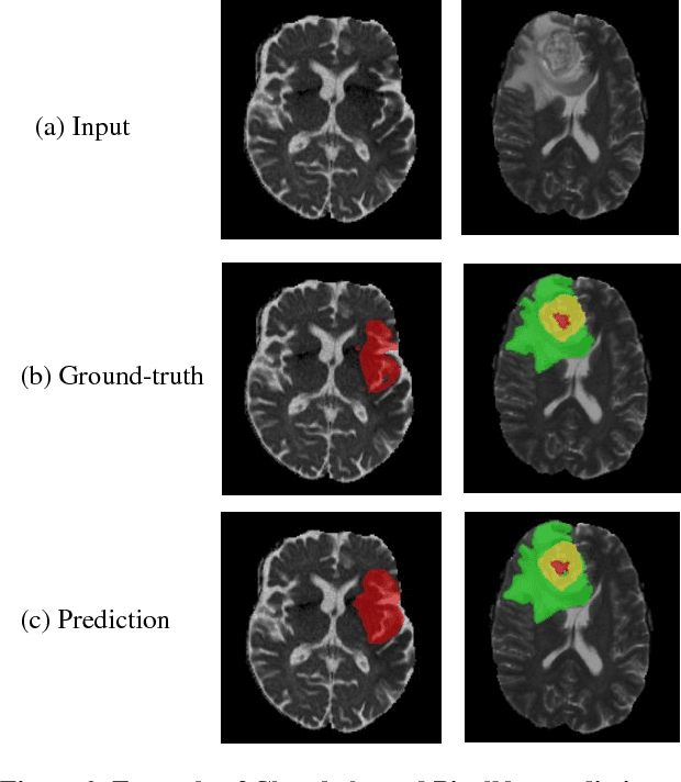 Figure 3 for Class Balanced PixelNet for Neurological Image Segmentation