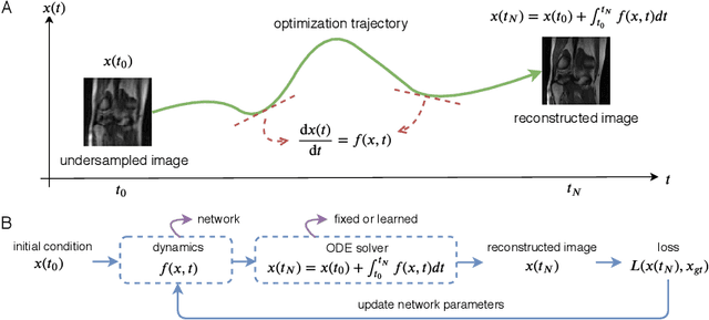 Figure 1 for MRI Image Reconstruction via Learning Optimization Using Neural ODEs