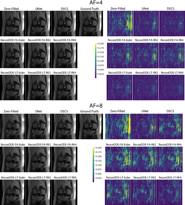 Figure 4 for MRI Image Reconstruction via Learning Optimization Using Neural ODEs