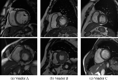 Figure 1 for Histogram Matching Augmentation for Domain Adaptation with Application to Multi-Centre, Multi-Vendor and Multi-Disease Cardiac Image Segmentation