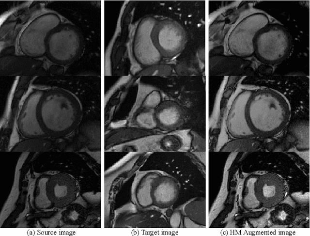 Figure 3 for Histogram Matching Augmentation for Domain Adaptation with Application to Multi-Centre, Multi-Vendor and Multi-Disease Cardiac Image Segmentation