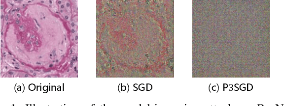 Figure 1 for P3SGD: Patient Privacy Preserving SGD for Regularizing Deep CNNs in Pathological Image Classification