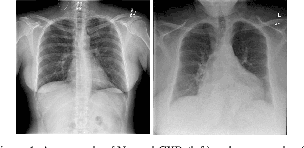 Figure 1 for Abnormality Detection and Localization in Chest X-Rays using Deep Convolutional Neural Networks