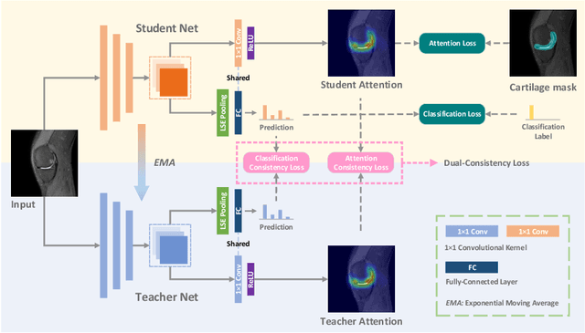 Figure 1 for A Self-ensembling Framework for Semi-supervised Knee Osteoarthritis Localization and Classification with Dual-Consistency