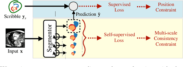 Figure 1 for Self-supervised Multi-scale Consistency for Weakly Supervised Segmentation Learning
