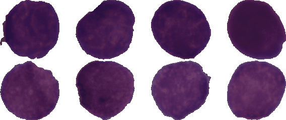 Figure 1 for SDCT-AuxNet$^θ$: DCT Augmented Stain Deconvolutional CNN with Auxiliary Classifier for Cancer Diagnosis