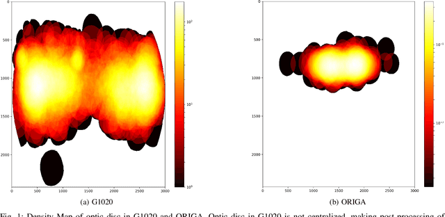 Figure 1 for G1020: A Benchmark Retinal Fundus Image Dataset for Computer-Aided Glaucoma Detection