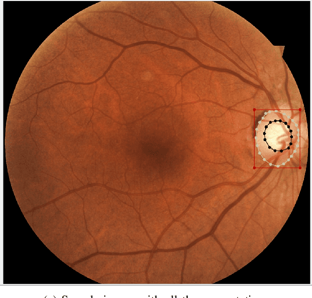 Figure 2 for G1020: A Benchmark Retinal Fundus Image Dataset for Computer-Aided Glaucoma Detection
