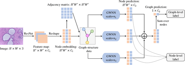 Figure 1 for MS-GWNN:multi-scale graph wavelet neural network for breast cancer diagnosis